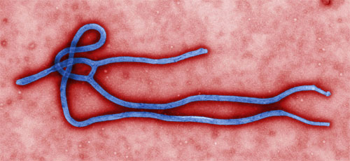 Expert says Ebola being spread in Africa because of such traditions as kissing&nbsp;corpses