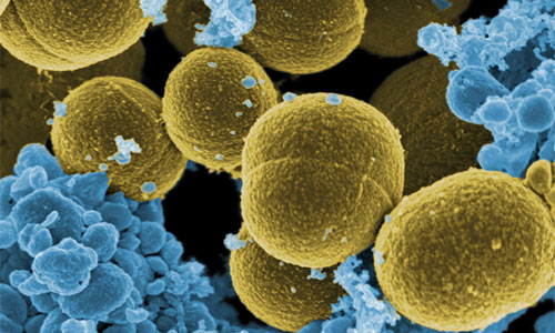 Microscopic image of S. Aureus bacteria escaping from human white blood cells: Photo Microbe World | Foter | CC BY-NC-SA