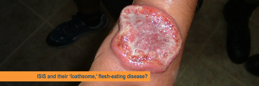 ISIS and their ‘loathsome,’ flesh-eating&nbsp;disease?