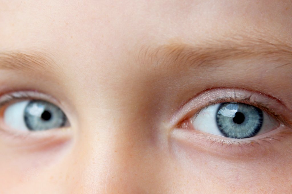 The problem with blue&nbsp;eyes